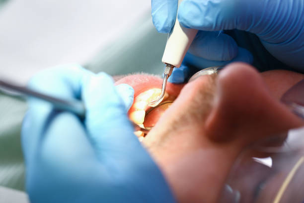 Best Emergency Treatment for Jaw Pain or Injury in Lynchburg, OH